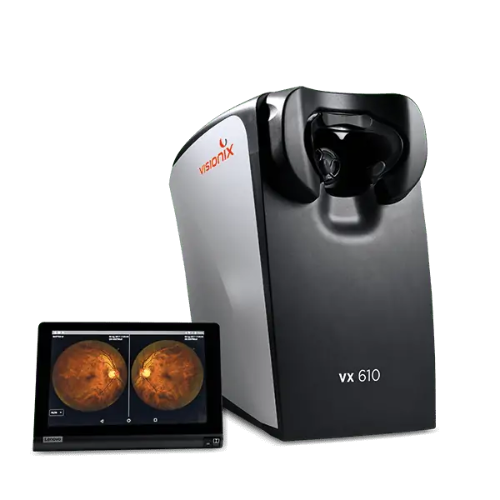 Visionix VX 610